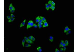 Immunofluorescence staining of HepG2 cells with ABIN7173382 at 1:166, counter-stained with DAPI. (TREM2 抗体  (AA 19-174))
