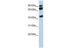 WB Suggested Anti-DDX17 Antibody Titration:  0. (DDX17 抗体  (N-Term))