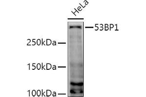 Western blot analysis of extracts of HeLa cells, using 53BP1 antibody (ABIN6128833, ABIN6149414, ABIN6149415 and ABIN6221431) at 1:1000 dilution. (TP53BP1 抗体  (AA 1763-1977))