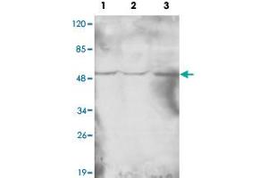 Western blot analysis of HAT1 monoclonal antibody  at 1 : 1000 dilution. (HAT1 抗体  (N-Term))