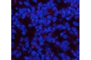 Immunofluorescence (IF) image for anti-Platelet Derived Growth Factor Receptor alpha (PDGFRA) antibody (ABIN7250356)