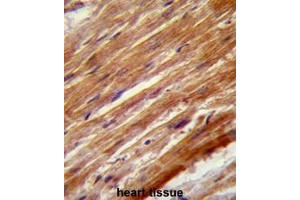 Formalin fixed and paraffin embedded human heart stained with MEKK4 Antibody (Center) Cat. (MAP3K4 抗体  (Middle Region))