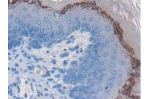 DAB staining on IHC-P; Samples: Mouse Esophagus Tissue (WFDC5 抗体  (AA 1-126))