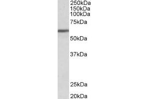 ABIN185457 (1µg/ml) staining of Human Breast cancer lysate (35µg protein in RIPA buffer). (ZNF703 抗体  (Internal Region))