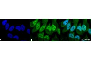 Immunocytochemistry/Immunofluorescence analysis using Rabbit Anti-Phosphothreonine Polyclonal Antibody . (Phosphothreonine 抗体  (Atto 594))