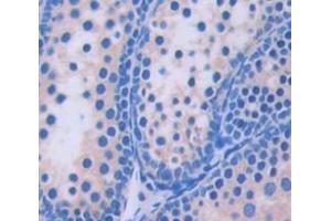 Used in DAB staining on fromalin fixed paraffin- embedded Kidney tissue (PEX1 抗体  (AA 172-377))