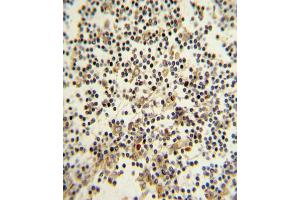 Formalin-fixed and paraffin-embedded human lymph with CD82 (ST6) Antibody (C-term), which was peroxidase-conjugated to the secondary antibody, followed by DAB staining. (CD82 抗体  (C-Term))