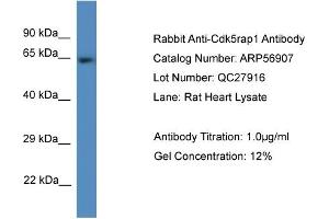 Western Blotting (WB) image for anti-CDK5 Regulatory Subunit Associated Protein 1 (CDK5RAP1) (C-Term) antibody (ABIN2774168) (CDK5RAP1 抗体  (C-Term))