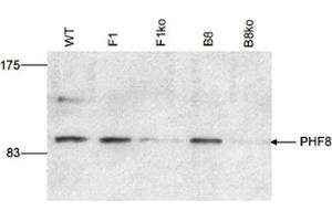 Western Blot results of Rabbit anti-PHF8 antibody Western Blot results of Rabbit anti-PHF8 antibody. (PHF8 抗体)