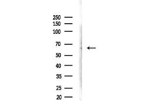 Western blot analysis of lysates from 3-L1 cells(heat-shock,45 min treatment), using Cytokeratin 2e Antibody at 1/1000 dilution.