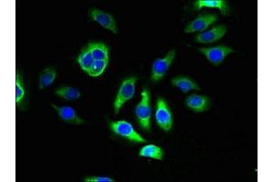 Immunofluorescent analysis of A549 cells using ABIN7173063 at dilution of 1:100 and Alexa Fluor 488-congugated AffiniPure Goat Anti-Rabbit IgG(H+L) (TMEM143 抗体  (AA 8-278))