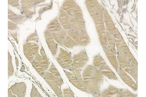 ABIN6258598 and ABIN6273579 at 1/100 staining human tongue carcinoma by IHC-P. (ALKBH3 抗体  (Internal Region))