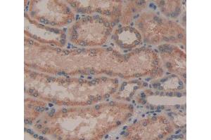 IHC-P analysis of kidney tissue, with DAB staining. (AGRN 抗体  (AA 1329-1548))