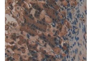 Immunohistochemistry (IHC) image for anti-Collagen, Type I, alpha 1 (COL1A1) (AA 1225-1453) antibody (ABIN7431647)