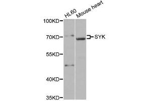 Western blot analysis of extracts of various cell lines, using SYK antibody. (SYK 抗体)