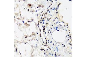 Immunohistochemistry of paraffin-embedded human lung using C antibody (ABIN7266546) at dilution of 1:100 (40x lens). (CAND1 抗体  (AA 750-980))