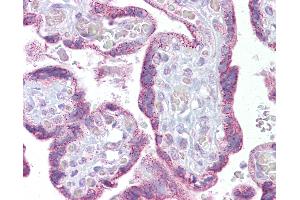 Immunohistochemistry (IHC) image for anti-Transient Receptor Potential Cation Channel, Subfamily C, Member 4 (TRPC4) (C-Term) antibody (ABIN958328)