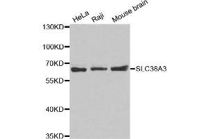 Western blot analysis of extracts of various cell lines, using SLC38A3 antibody. (SLC38A3 抗体  (AA 1-65))