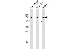 All lanes : Anti-HTR2C Antibody (Center) at 1:4000 dilution Lane 1: SH-SY5Y whole cell lysates Lane 2: MOLT-4 whole cell lysates Lane 3: A431 whole cell lysates Lysates/proteins at 20 μg per lane. (HTR2C 抗体  (AA 274-308))