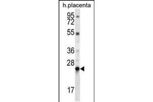 Western blot analysis in human placenta tissue lysates (35ug/lane). (LHFPL1 抗体  (N-Term))