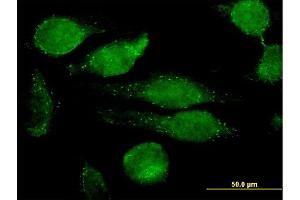 Immunofluorescence of monoclonal antibody to GRN on HeLa cell. (Granulin 抗体  (AA 494-593))