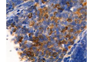ABIN6261455 and ABIN6277691 at 1/100 staining Mouse thymus tissue by IHC-P.