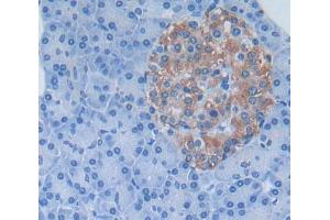 Used in DAB staining on fromalin fixed paraffin- embedded Kidney tissue (KREMEN1 抗体  (AA 157-390))