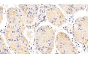 Detection of a2M in Human Stomach Tissue using Polyclonal Antibody to Alpha-2-Macroglobulin (a2M) (alpha 2 Macroglobulin 抗体  (AA 616-856))