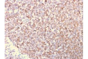 Immunohistochemistry (IHC) image for anti-Lymphocyte-Specific Protein 1 (LSP1) (AA 174-278) antibody (ABIN6939969)