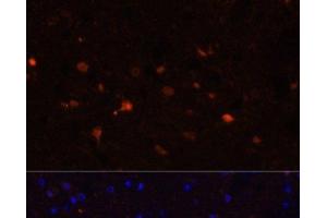 Immunofluorescence analysis of Mouse brain using S100B Polyclonal Antibody at dilution of 1:100. (S100B 抗体)