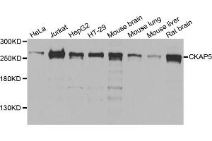 Western blot analysis of extracts of various cell lines, using CKAP5 antibody. (CKAP5 抗体)