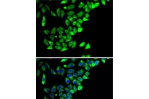Immunofluorescence analysis of A-549 cells using PTGES2 Polyclonal Antibody (PTGES2 抗体)
