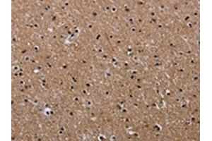 The image on the left is immunohistochemistry of paraffin-embedded Human brain tissue using ABIN7128956(CLDND1 Antibody) at dilution 1/50, on the right is treated with fusion protein. (CLDND1 抗体)