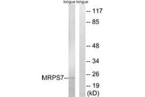 Western blot analysis of extracts from rat tongue cells, using MRPS7 Antibody. (MRPS7 抗体  (AA 91-140))