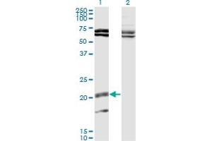 Western Blot analysis of IL17B expression in transfected 293T cell line by IL17B monoclonal antibody (M02), clone 1G6. (IL17B 抗体  (AA 23-122))