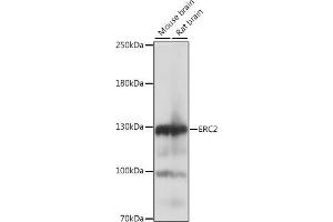 Western blot analysis of extracts of various cell lines, using ERC2 antibody (ABIN7266918) at 1:1000 dilution. (ERC2 抗体  (AA 770-850))