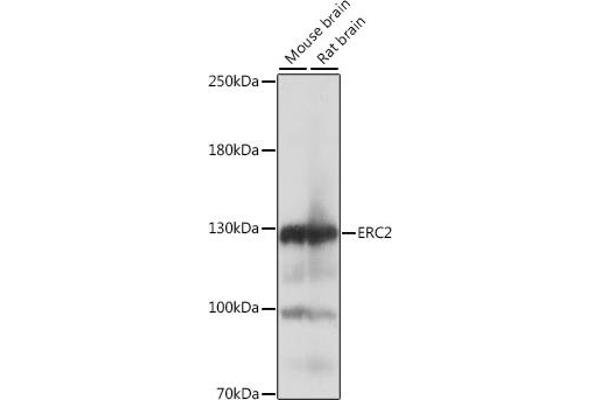 ERC2 抗体  (AA 770-850)
