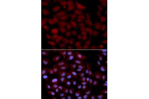 Immunofluorescence analysis of U2OS cells using TNK2 antibody (ABIN5971357). (TNK2 抗体)