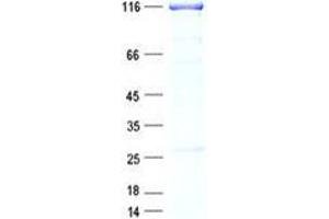 Western Blotting (WB) image for Denticleless E3 Ubiquitin Protein Ligase Homolog (DTL) protein (GST tag,His tag) (ABIN5505614)
