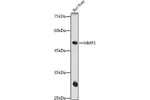Western blot analysis of extracts of Rat liver, using MMP3 antibody (ABIN3021708, ABIN3021709, ABIN3021710 and ABIN6215578) at 1:1000 dilution.