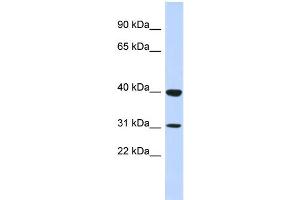 WB Suggested Anti-ZNF660 Antibody Titration:  0. (ZNF660 抗体  (N-Term))