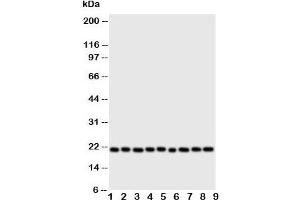Western blot testing of Cytoglobin antibody and Lane 1:  rat brain;  2: (r) small intestine;  3: (r) liver;  4: (r) kidney;  5: human SGC;  6: (h) COLO320;  7: SMMC-7721;  8: PANC;  9: HeLa cell lysate. (CYGB 抗体  (N-Term))