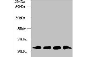 Western blot All lanes: MRPL18 antibody at 8 μg/mL Lane 1: U251 whole cell lysate Lane 2: THP-1 whole cell lysate Lane 3: PC-3 whole cell lysate Lane 4: U87 whole cell lysate Secondary Goat polyclonal to rabbit IgG at 1/10000 dilution Predicted band size: 21 kDa Observed band size: 21 kDa (MRPL18 抗体  (AA 14-180))