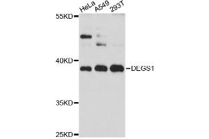 Western blot analysis of extracts of various cell lines, using DEGS1 antibody (ABIN6294024) at 1:3000 dilution. (DEGS1 抗体)