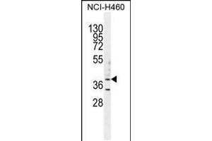 Western blot analysis in NCI-H460 cell line lysates (35ug/lane). (B3GALT5 抗体  (N-Term))