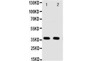 Anti-Annexin A10 antibody, Western blotting Lane 1: A549 Cell Lysate Lane 2: A549 Cell Lysate (Annexin a10 抗体  (C-Term))