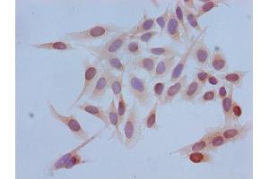 Immunocytochemistry analysis of Hela cells using ABIN7139671 at dilution of 1:100 (HIST1H3A 抗体  (3meLys4))