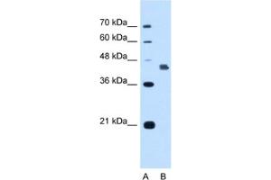 Western Blotting (WB) image for anti-Deafness, Autosomal Dominant 5 (DFNA5) antibody (ABIN2462940) (DFNA5 抗体)