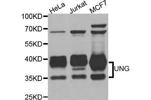 Western blot analysis of extracts of various cell lines, using UNG antibody. (UNG 抗体)