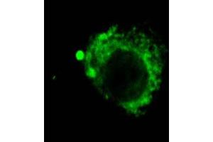 LAMP2 (GL2A7), IF showing distribution of lysosomes in CEC  Courtesy of Eunduck E P Kay, Doheny Eye Institue. (LAMP2 抗体)